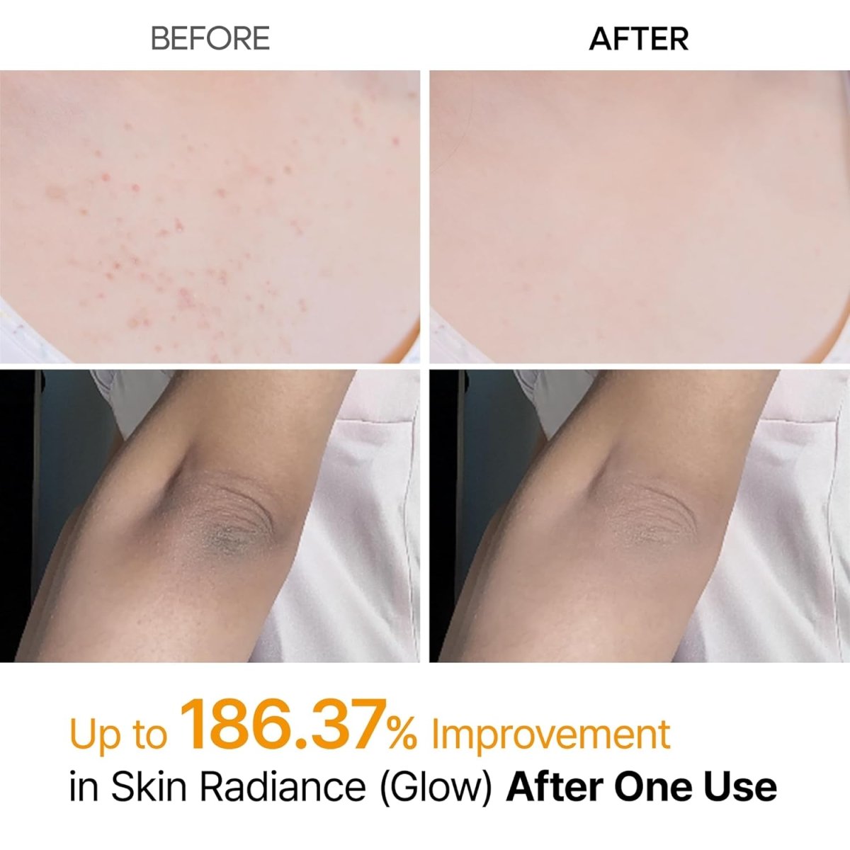 Peel Shot Keratin - Heath Insider