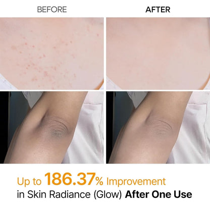 Peel Shot Keratin - Heath Insider